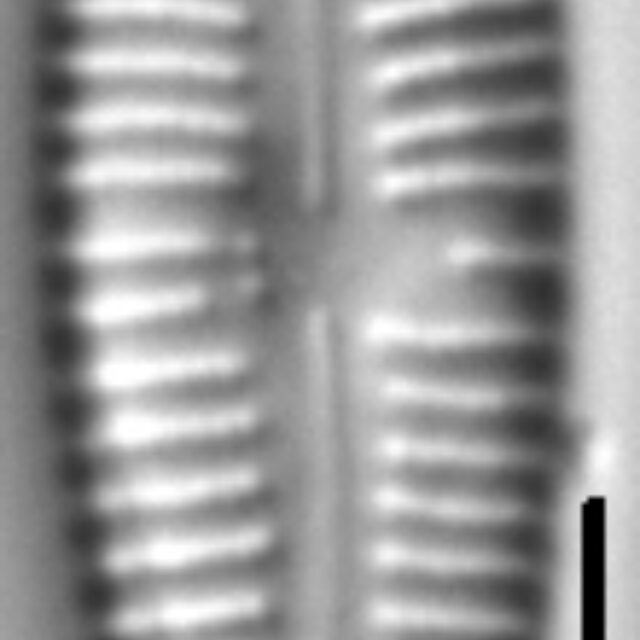 Gomphonema multipunctatum LM5