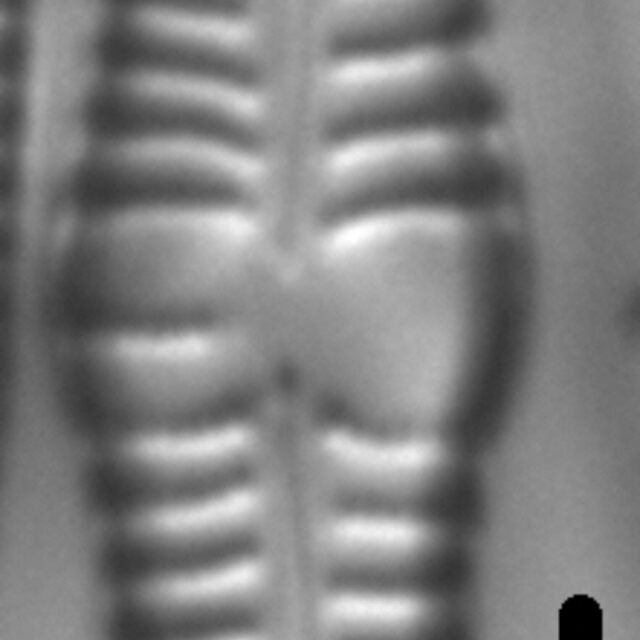 Gomphonema distans LM5