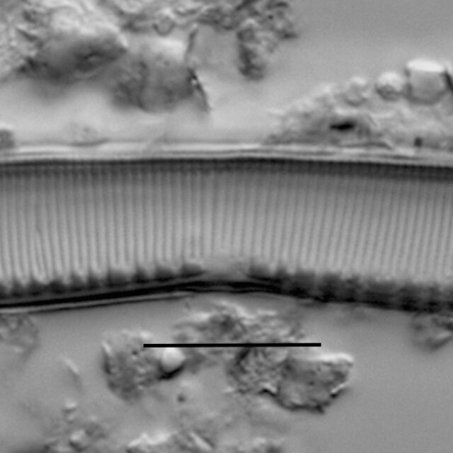 Haduplicate Amphioxys Gc61088 010