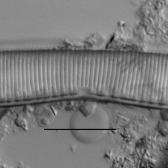 Haduplicate Amphioxys Gc61088 Oo5