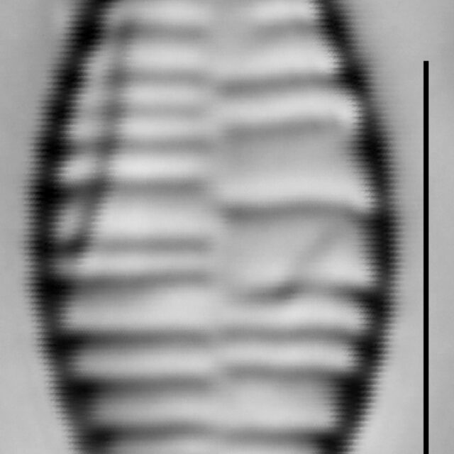 Fragilariforma bicapitata LM5