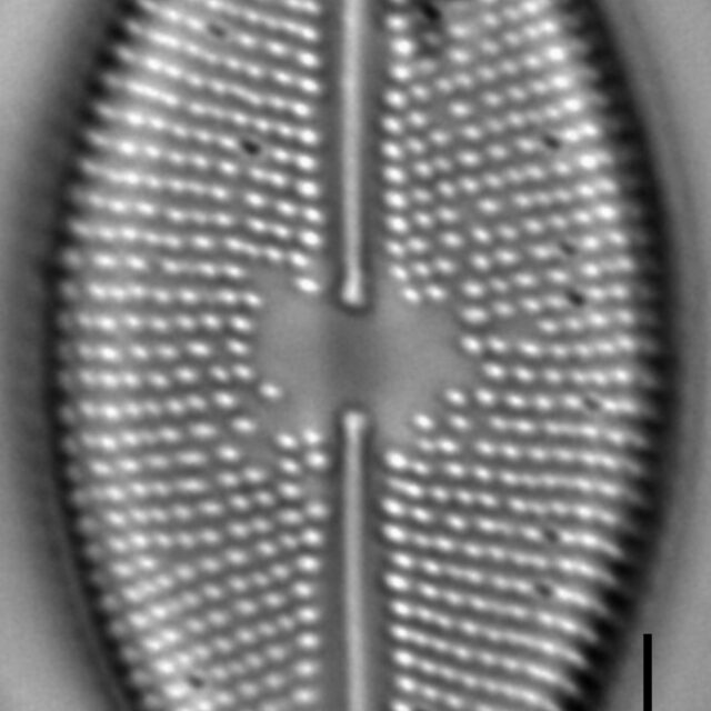 Lacustriella lacustris LM3