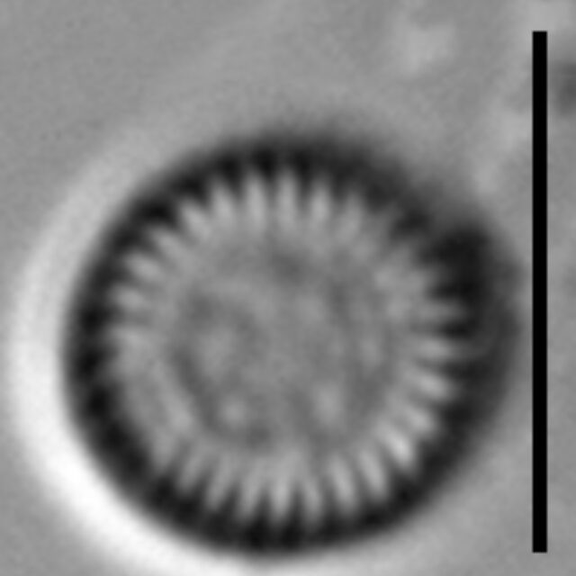 Lindavia comensis LM3