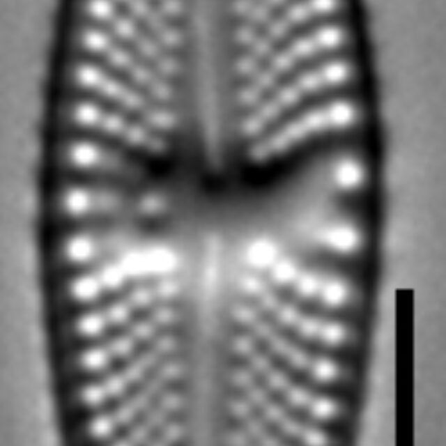 Luticola ignorata LM7