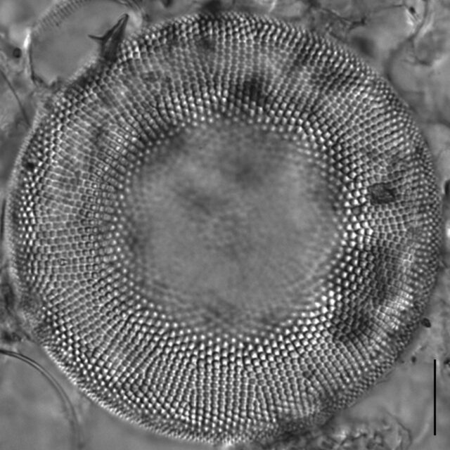 Actinocyclus normanii_LM4