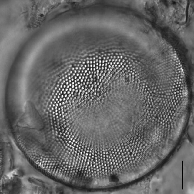 Actinocyclus normanii_LM5