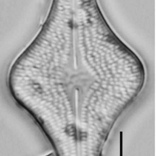 Brachysira follis LM1