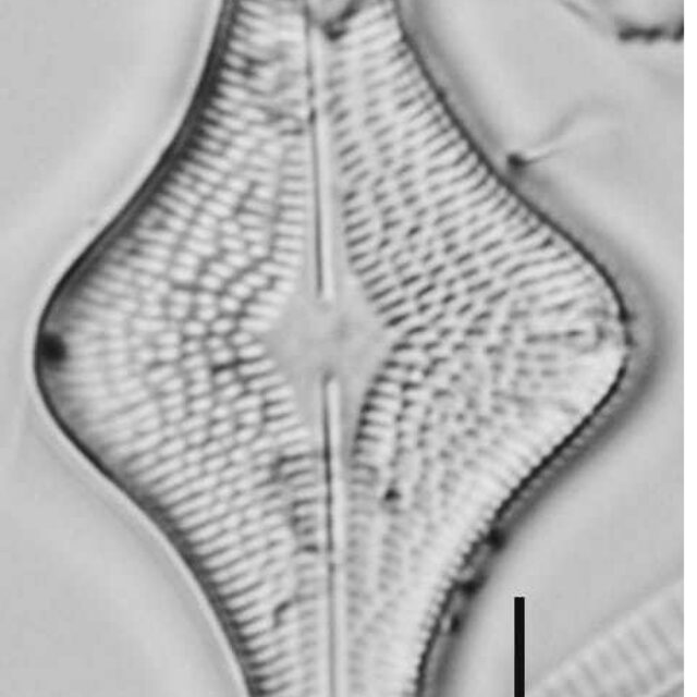 Brachysira follis LM7