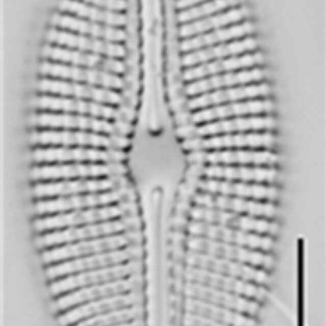 Diploneis calcilacustris LM2