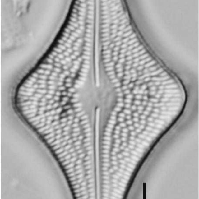 Brachysira follis LM6