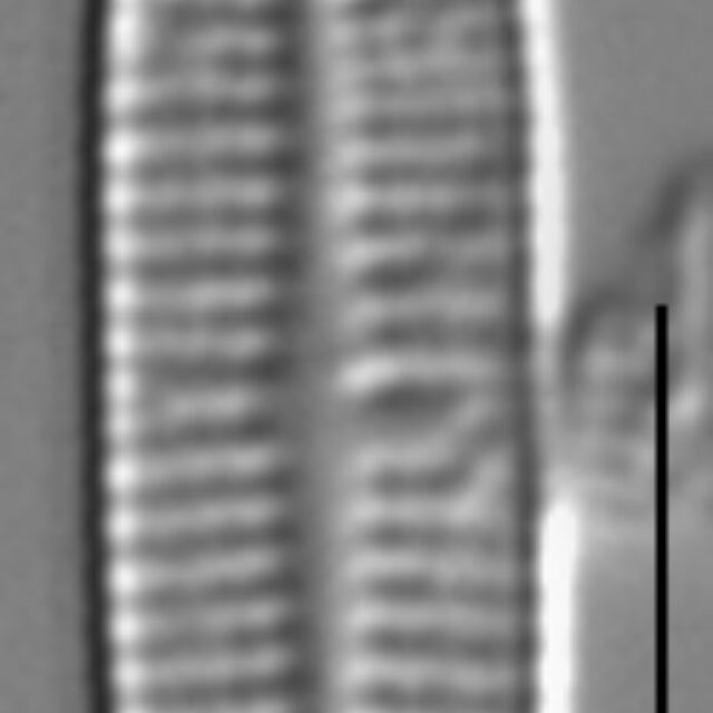 Achnanthidium gracillimum LM2