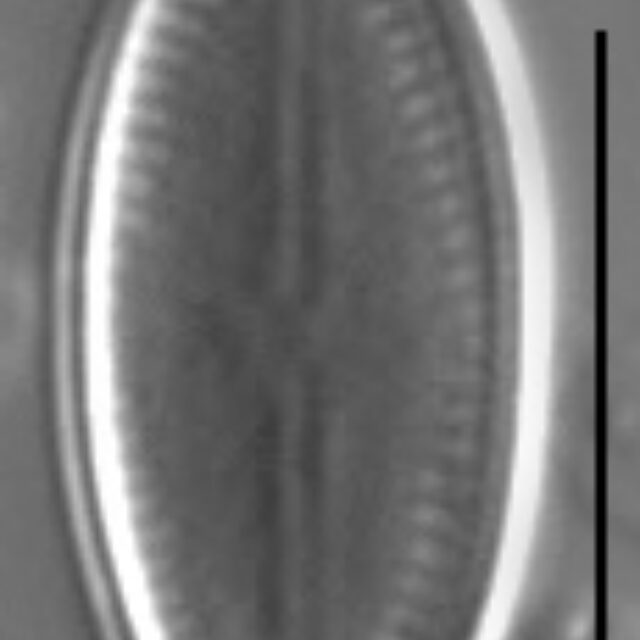 Psammothidium acidoclinatum LM2