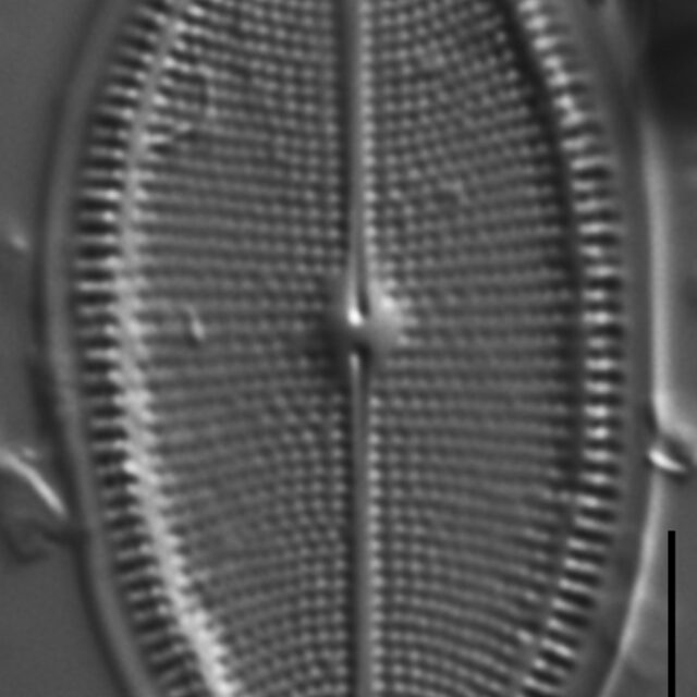 Cocconeis placentula LM1