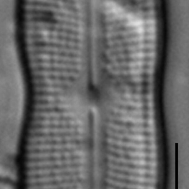 Neidiomorpha binodiformis LM4