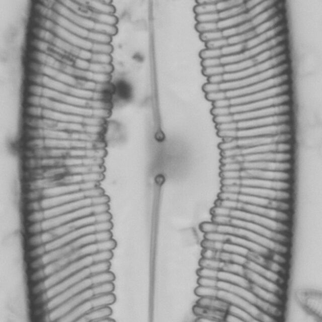 Pinnularia alabamae LM5