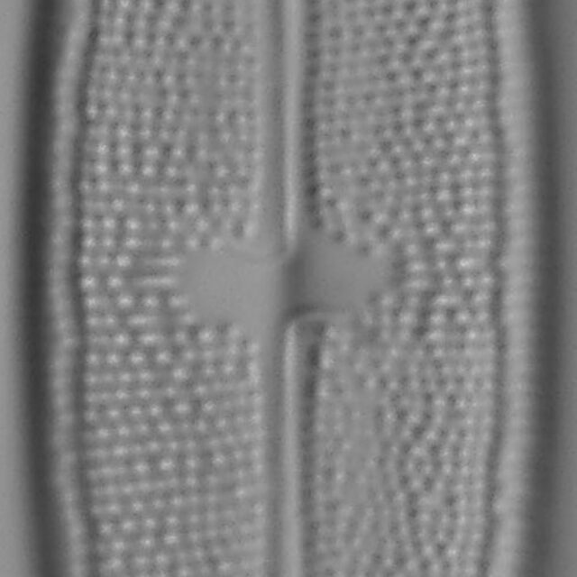 Neidium Productum Lm3