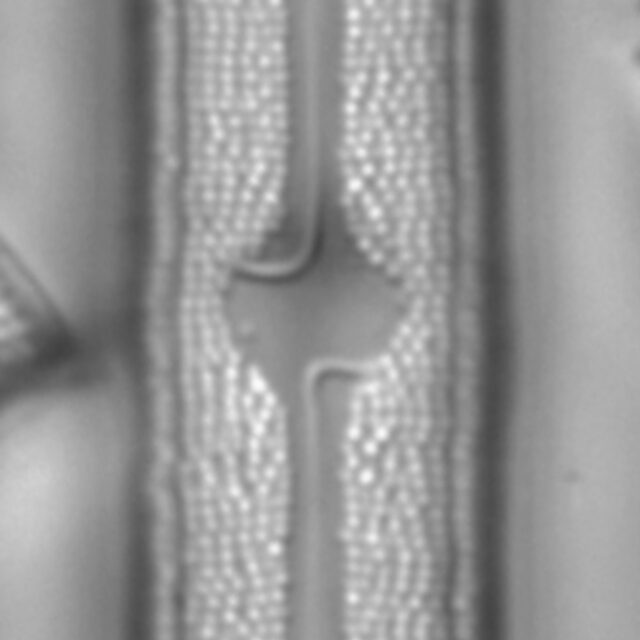 Neidium bisulcatum LM5