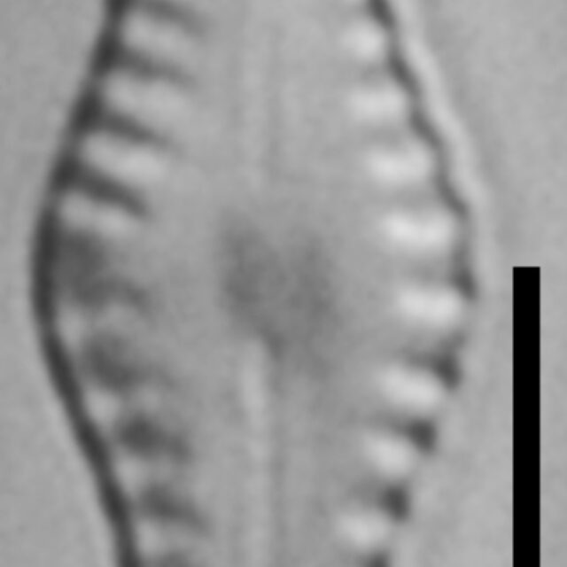 Ninastrelnikovia gibbosa LM3