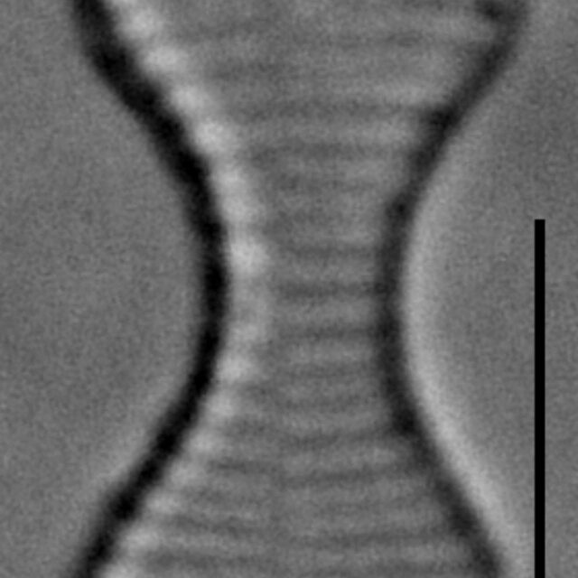 Oxyneis binalis LM6