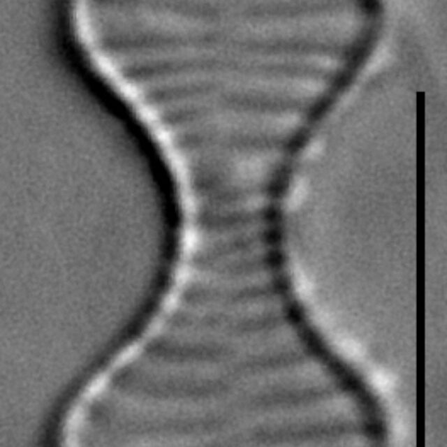 Oxyneis binalis LM5