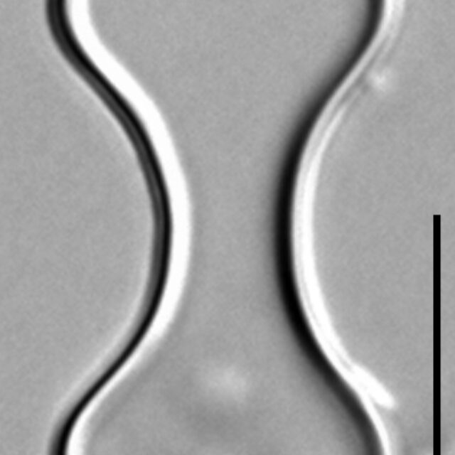 Oxyneis binalis LM4