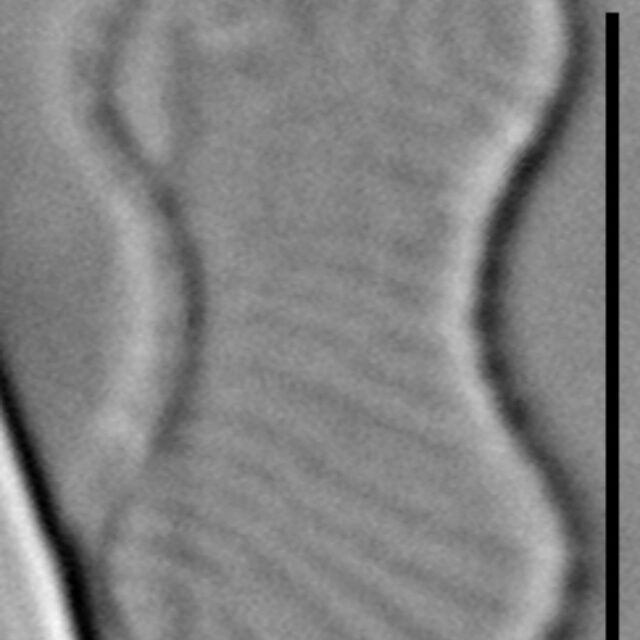 Oxyneis binalis LM3