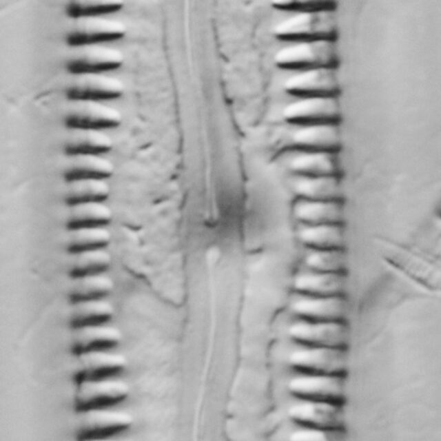 Pinnularia cuneicephala LM1