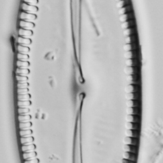 Pinnularia formica LM6