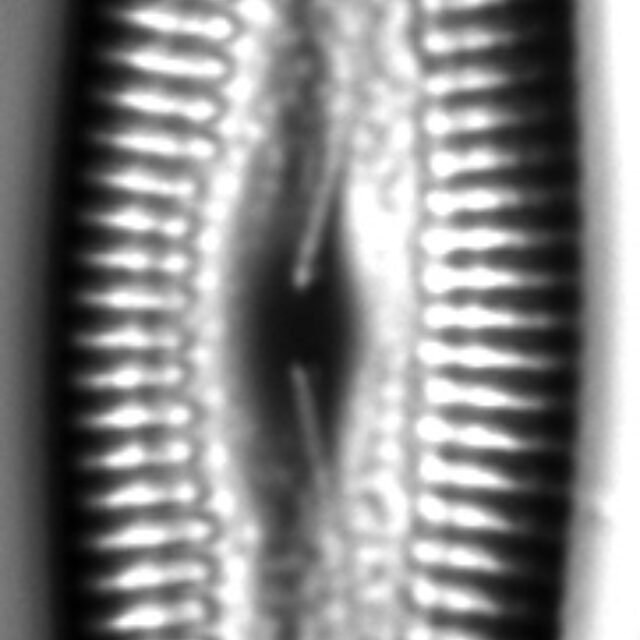 Pinnularia acrosphaeria LM5