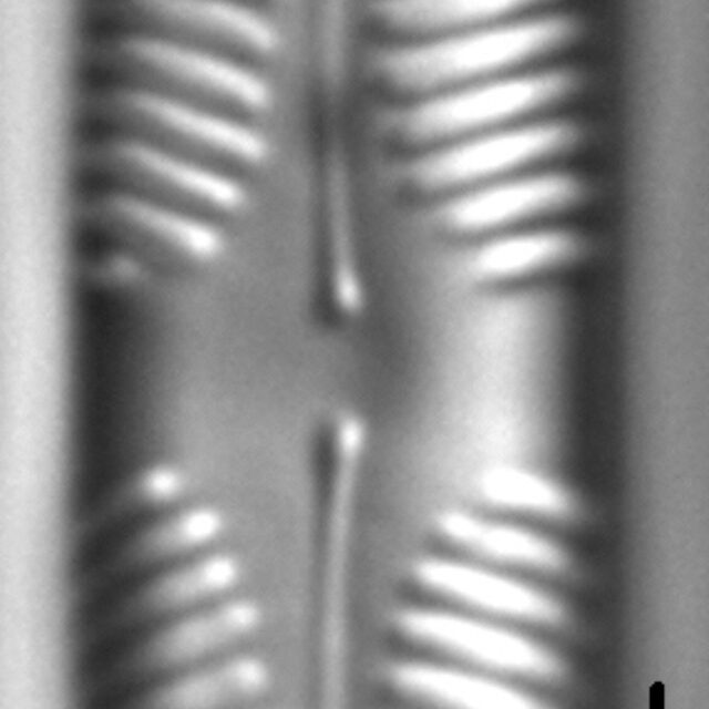 Pinnularia brebissonii LM3