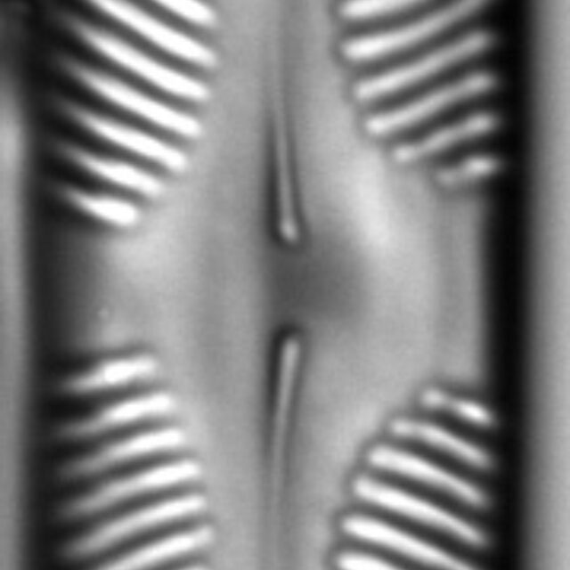 Pinnularia rhombarea LM6