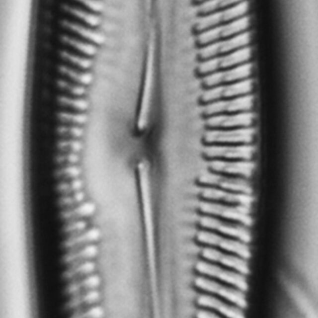 Pinnularis transversa LM7