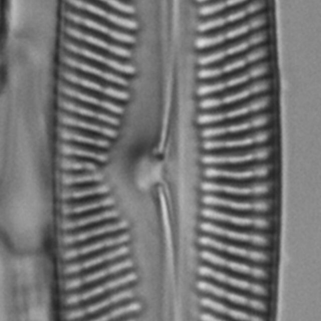 Pinnularis transversa LM1