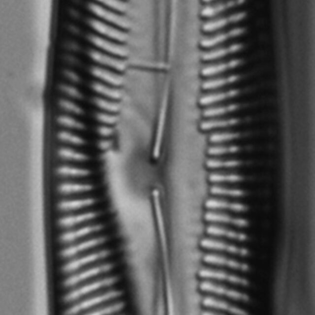 Pinnularis transversa LM6