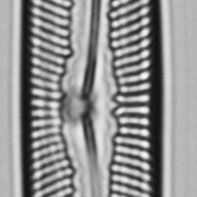 Pinnularis transversa LM4