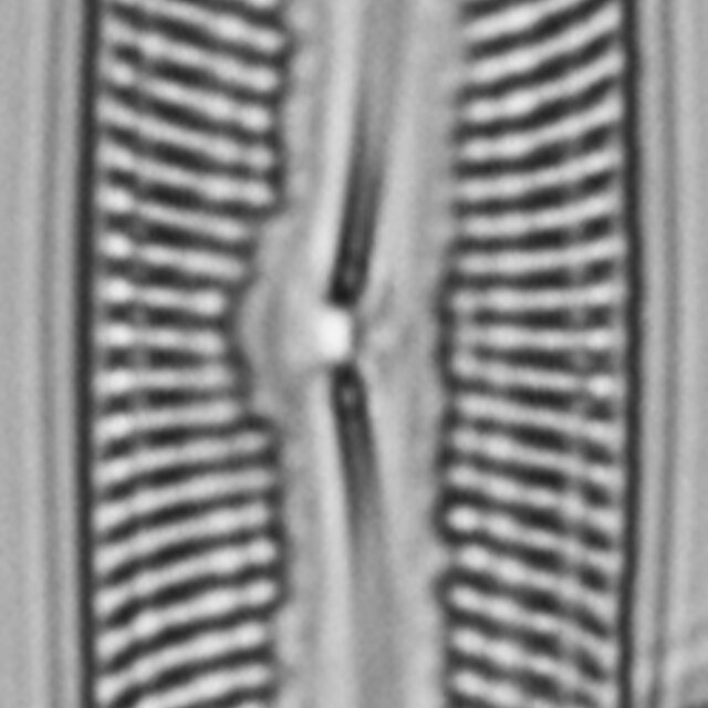 Pinnularis transversa LM3