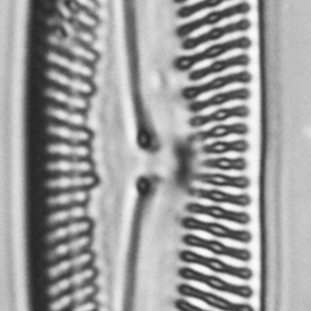 Pinnularis transversa LM2