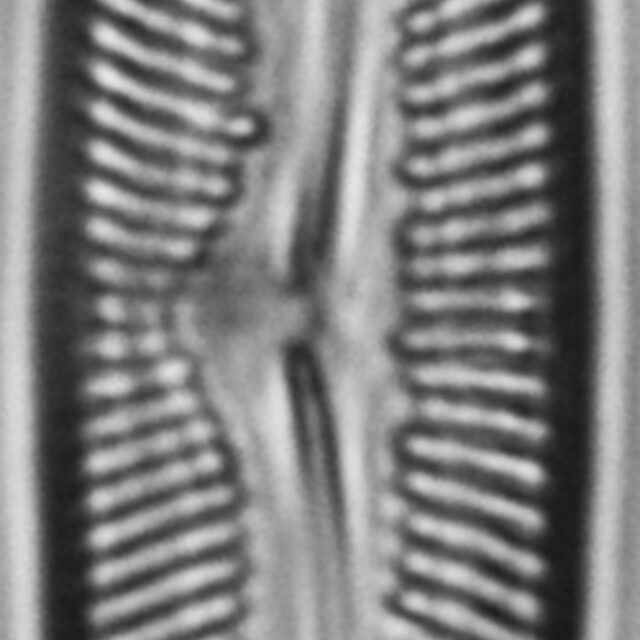 Pinnularis transversa LM5