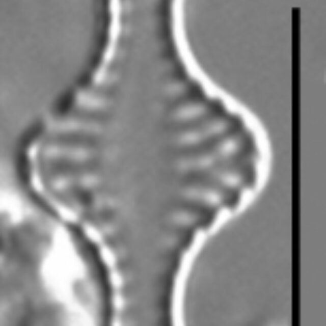 Pseudostaurosira pseudoconstruens LM7