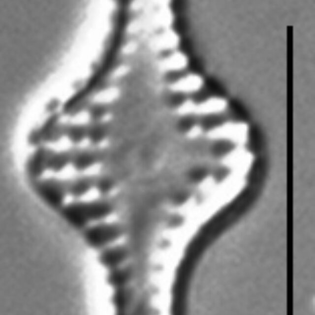 Pseudostaurosira pseudoconstruens LM6