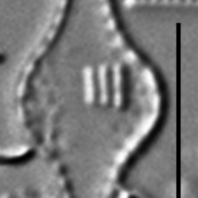 Pseudostaurosira pseudoconstruens LM4