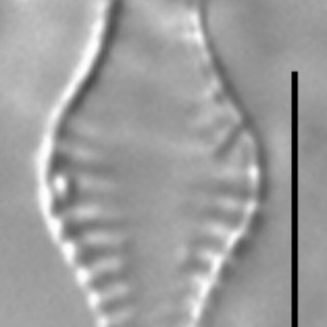 Pseudostaurosira pseudoconstruens LM5