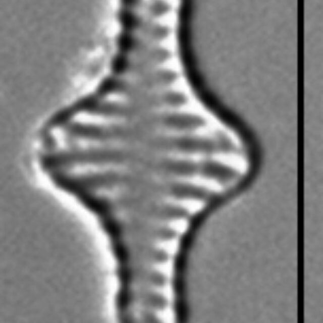 Pseudostaurosira pseudoconstruens LM3