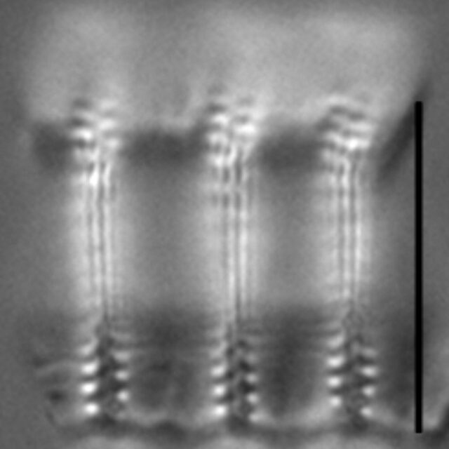 Pseudostaurosira pseudoconstruens LM1