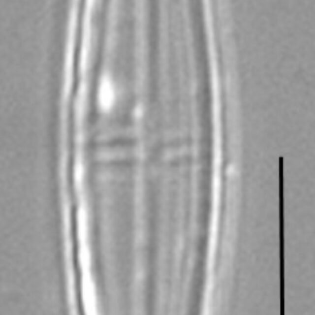 Proschkinia Browderiana Lm3