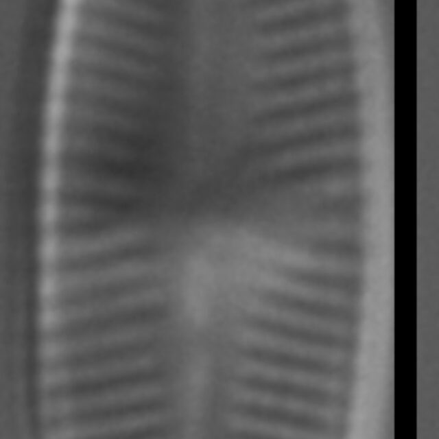 Psammothidium sacculum LM3