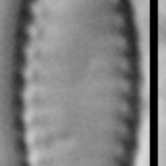 Pseudostaurosira microstriata LM3