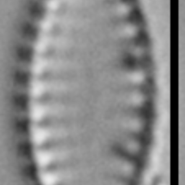 Pseudostaurosira microstriata LM4