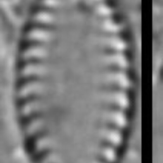 Pseudostaurosira microstriata SMM 13305b 6