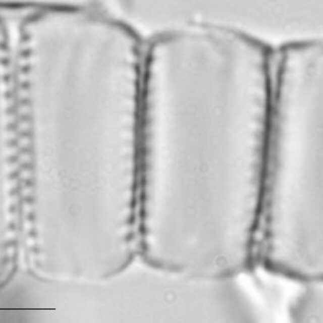 Pseudostaurosira neoelliptica LM2